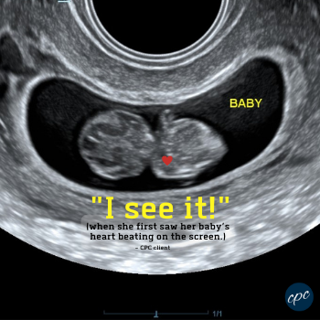 Ultrasound - "I see"